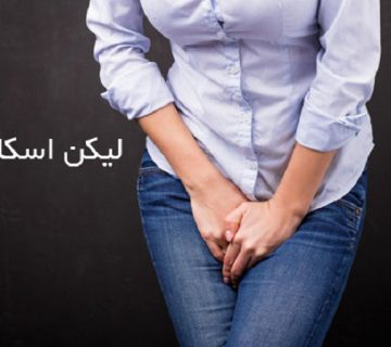 دوران یائسگی و بیماری لیکن اسکلروزیس | بهترین متخصص زنان و زایمان اصفهان