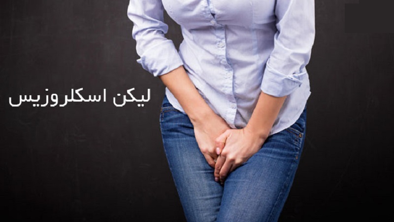 دوران یائسگی و بیماری لیکن اسکلروزیس | بهترین متخصص زنان و زایمان اصفهان