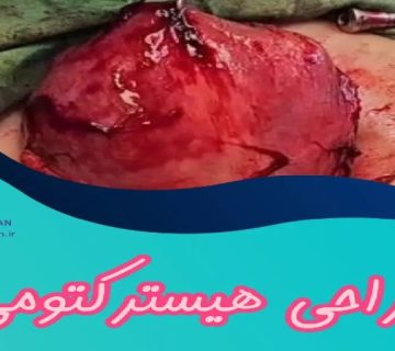 متخصص زنان و زایمان اصفهان | جراحی هیسترکتومی