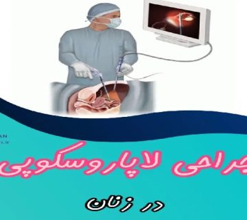 متخصص زنان و زایمان اصفهان | جراحی لاپاروسکوپی در زنان