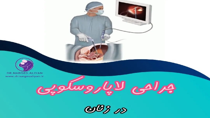 متخصص زنان و زایمان اصفهان | جراحی لاپاروسکوپی در زنان