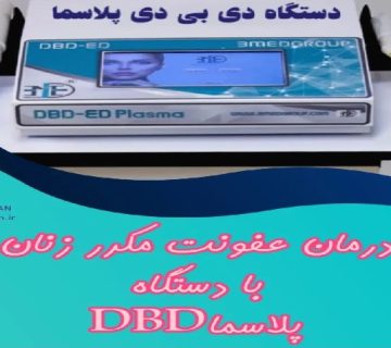 متخصص زنان و زایمان اصفهان | درمان عفونت زنان با دستگاه DBD پلاسما