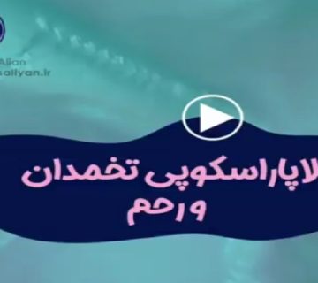 متخصص زنان و زایمان اصفهان | لاپاراسکوپی تخمدان و رحم